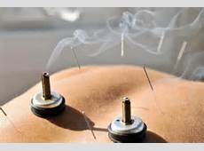acupuncture schools in johannesburg Fishers Hill Clinic Acupuncture And Chinese Massage