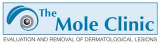 Mole evaluation & removal