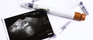 clinics artificial insemination johannesburg Zoe Fertility Clinic