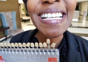 teeth whitening in johannesburg Betta Smile Johannesburg Teeth Whitening
